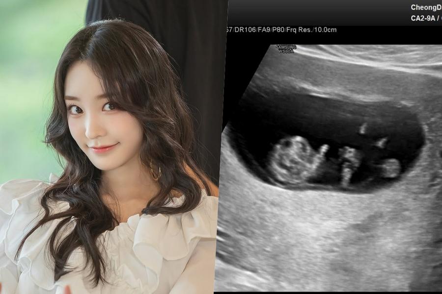 SONAMOO's Nahyun Announces Pregnancy And Plans To Get Married Next Year